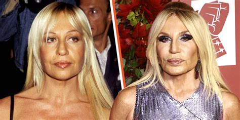 donatella versace 1986|donatella versace before surgery.